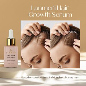 Lanmeri Vegan Hair Growth Serum - Natural Hair Regrowth and Hair Loss Treatments for Women & Men - Scalp Serum for Thinning Hair and Hair Loss - Fuller-looking, Thicker and Healthier Hair in 90 Days, All Hair Types