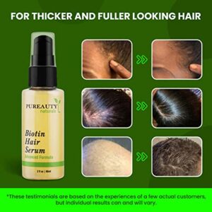 Biotin Hair Growth Serum - Biotin serum & Hair growth oil and hair serum - Topical hair growth product for thicker looking hair growth for women & men hair loss serum - Biotin oil by Pureauty Naturals