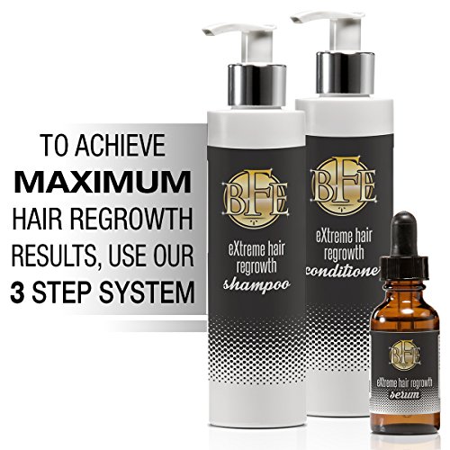 Hair Regrowth Serum- Maximum Strength DHT Blocker. Repairs & Stimulates New Follicle Hair Growth. Grow Stronger, Thicker, Fuller, Longer, Healthier Hair. For Men & Women with No Side Effects.