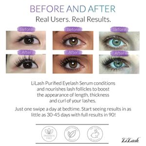 LiLash Purified Eyelash Physician-Formulated Serum for Fuller & Longer Looking Eyelashes | Natural Eyelash Enhancer Safe for Sensitive Eyes & Contact Lens Wearers | 90-Day Supply (2mL)