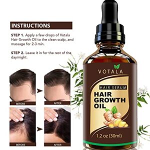 Hair Growth Serum, VOTALA Hair Growth Treatment, Anti Hair Loss, Promotes Thicker, Stronger Hair, And Hair Regrowth for Men Women