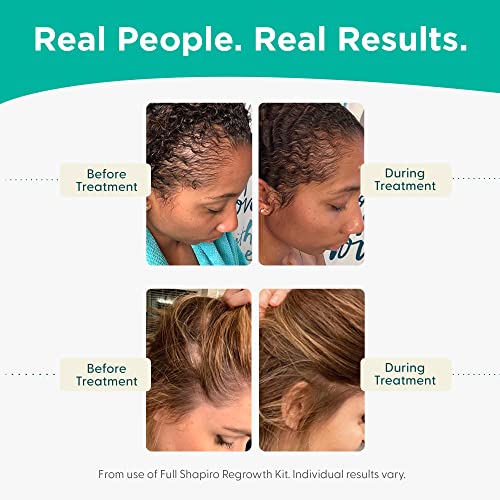 Women’s Hair Regrowth Travel Kit: Leave-In Foamer, 2% Minoxidil. Experience Healthier, Fuller, and Thicker looking Hair with Shapiro MD