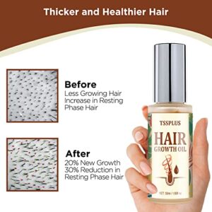 TSSPLUS Hair growth rapid, Hair growth serum,hair growth oil, hair loss treatments, hair oil for dry damaged hair and growth, Hair Growth Serum for Thicker longer fuller healthier hair ,Biotin & Castor oil & Rosemary Oil v2 (#01 Pack of 1)