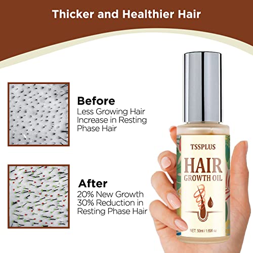 TSSPLUS Hair growth rapid, Hair growth serum,hair growth oil, hair loss treatments, hair oil for dry damaged hair and growth, Hair Growth Serum for Thicker longer fuller healthier hair ,Biotin & Castor oil & Rosemary Oil v2 (#01 Pack of 1)