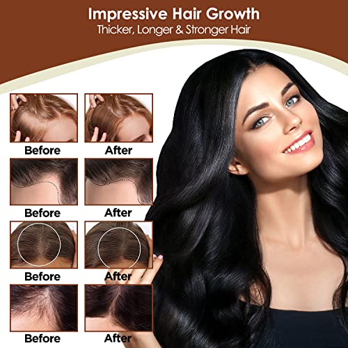 TSSPLUS Hair growth rapid, Hair growth serum,hair growth oil, hair loss treatments, hair oil for dry damaged hair and growth, Hair Growth Serum for Thicker longer fuller healthier hair ,Biotin & Castor oil & Rosemary Oil v2 (#01 Pack of 1)