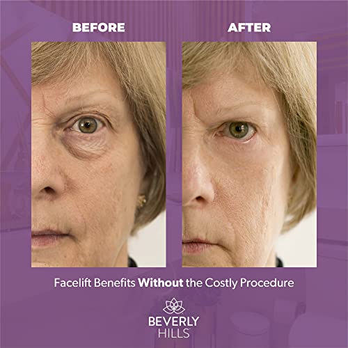 Beverly Hills Instant Facelift Anti Aging Eye Serum Treatment for Dark Circles, Puffy Eyes, Wrinkles, Under Eye Bags, Fine Lines, and Crows Feet that Works Within 90 Seconds | 30mL (120 Days Supply)
