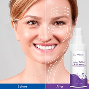 St. Mege Face Lift Cream, Instant Skin Tightening Cream for Face, Instant Eye Lift, Rapid Eye Cream, Smooth Appearance of Loose Sagging Skin Within 2 Minutes 30ML