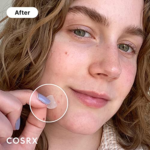 COSRX Acne Pimple Patch (96 Counts) Absorbing Hydrocolloid Original 3 Size Patches for Blemishes and Zits Cover, Spot Stickers for Face and Body, Not Tested on Animals, No Toxic Ingredients