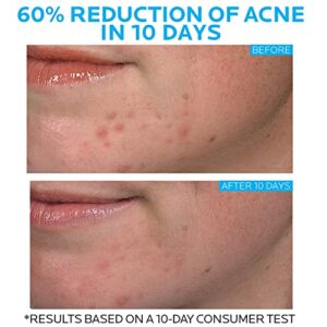 La Roche-Posay Effaclar Duo Dual Action Acne Spot Treatment Cream with Benzoyl Peroxide Acne Treatment, Blemish Cream for Acne and Blackheads, Safe For Sensitive Skin, 1.35 Fl Oz (Pack of 1)