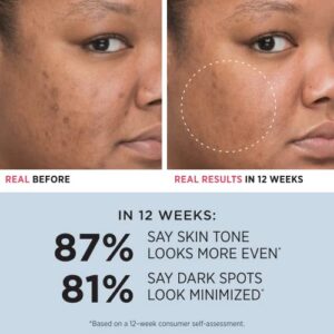 IT Cosmetics Bye Bye Dark Spots 4% Niacinamide Serum - Visibly Reduces Dark Spots & Improves Skin Clarity In 8 Weeks - With 1% Ethyl Vitamin C - For All Skin Types - 1 fl oz