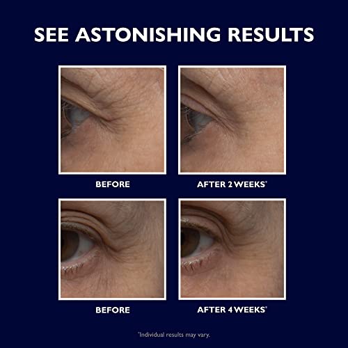 Retinol Fusion PM Eye Cream | Retinol Eye Cream for Dark Circles and Puffiness, Anti-Aging Eye Cream