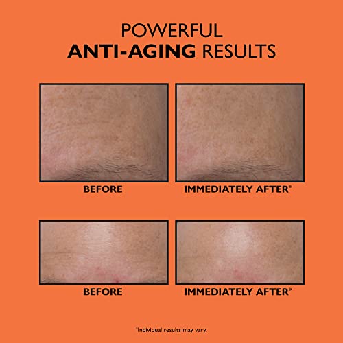 Anti-Aging Triple Acid Peel | Exfoliator and AHA/BHA Peel for Fine Lines, Wrinkles, Uneven Texture and Tone