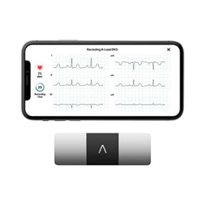 KardiaMobile 6-Lead Personal EKG Monitor – Six Views of The Heart – Detects AFib and Irregular Arrhythmias – Instant Results in 30 Seconds – Works with Most Smartphones - FSA/HSA Eligible