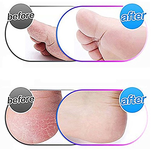 4 Pack Replacement Roller Refills Compatible with Scholl Express Pedi Foot Smoother-Extra Coarse