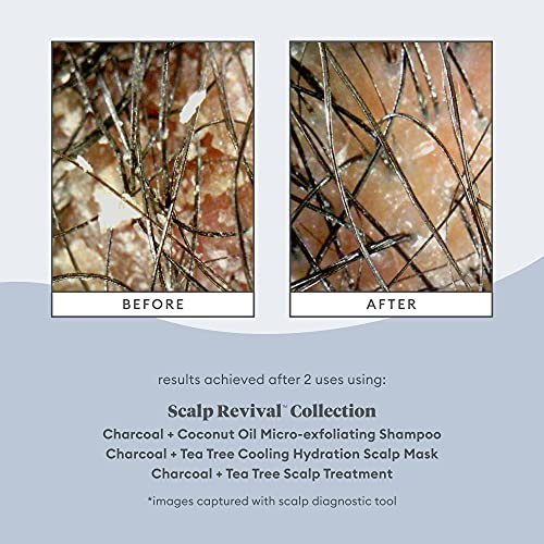 Briogeo Scalp Revival Charcoal + Tea Tree Scalp Treatment | Scalp Serum to Soothe a Dry, Flaky, Itchy Scalp | Vegan, Phalate & Paraben-Free | 1 Ounce