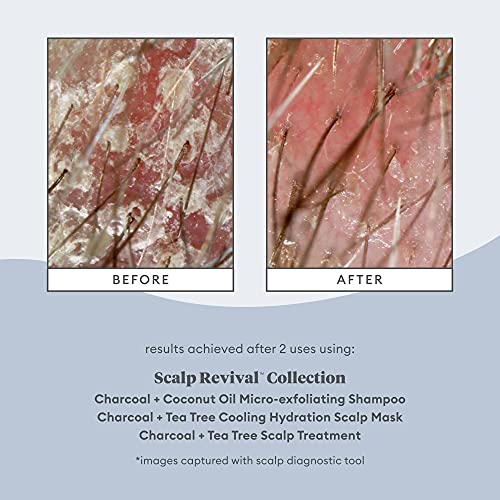 Briogeo Scalp Revival Charcoal + Tea Tree Scalp Treatment | Scalp Serum to Soothe a Dry, Flaky, Itchy Scalp | Vegan, Phalate & Paraben-Free | 1 Ounce