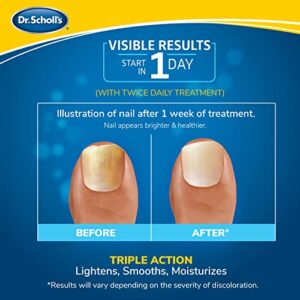 Dr. Scholl's Fungal Nail Treatment Revitalizer LED Light-Activated Therapy, Erase Toenail Discoloration Fungus, 10 ml