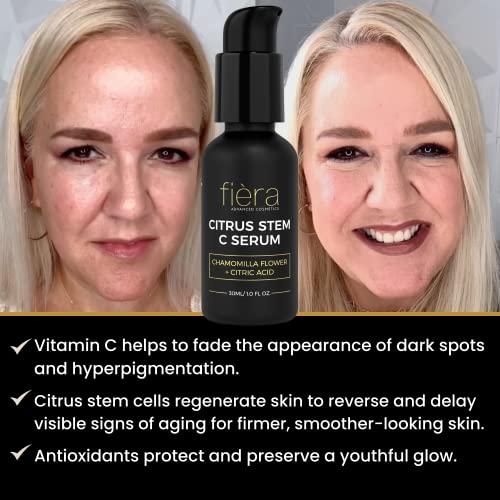 Fièra Vitamin C Serum, Hyaluronic Acid and Citrus Stem Cells - Anti Aging Serum for Brightening, Firming, and Hydrating Face & Eye Area - 30 ML / 1 FL. OZ.