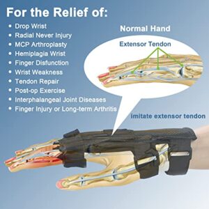 Feamero Radial Nerve Palsy Splint, Adjustable Finger Lift Elastic Strap Arm Brace Splint for Drop Wrist, Radial Nerve Injury, Mcp Arthroplasty, Finger Injury Arthritis, Unisex Fit Left & Right Hand