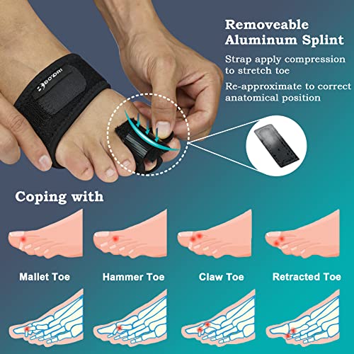 Boydri Toe Rigid Splint Stabilizers, Toe Straightener & Corrector Brace for Fixation Broken Toe, Stress Fracture, Claw Toe and Mallet Toe, Toe Separator - Adjustable Toe Support (S/M)