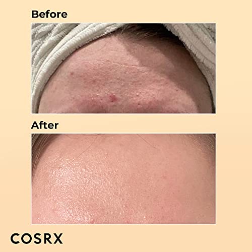 COSRX Post Acne Mark Recovery - Snail Mucin 96% Essence + Vitamin C 23% Serum, Intensive Hydrating for Fine lines, Hyperpigmentation, After Blemish Care