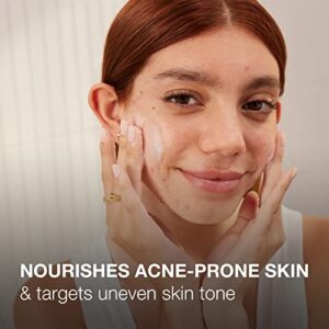 Neutrogena Ultra Gentle Face Gel Hydrator with Pro-Vitamin B5 & 4% Niacinamide Designed for Acne-Prone Skin, Lightweight Gel Cream Targets Uneven Skin Tone, Fragrance-Free, 5.0 oz