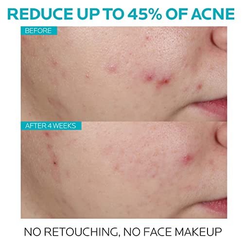 La Roche Posay Effaclar Salicylic Acid Acne Treatment to Minimize Pores, Clear Acne Blemishes and Post Acne Marks