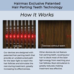 Hairmax Laser Hair Growth Comb (FDA Cleared), ULTIMA 9 Classic, Laser Hair Growth Treatment for Men & Women, Thinning Hair Treatment for Women and Men, Denser/Fuller Hair, Spot or Full Scalp, Hair Growth Products to Reverse Thinning Hair, 100% Medical Gra