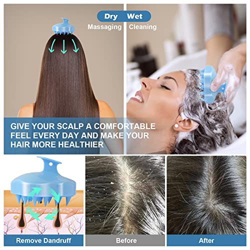 URTHEONE Hair Scalp Massager Shampoo Brush,Soft Silicone Hair Brush for Wet Dry Oily Curly Straight Thick Thin Rough Long Short Natural Men Women Kids Pets Hair Care Tools(Sky Blue)