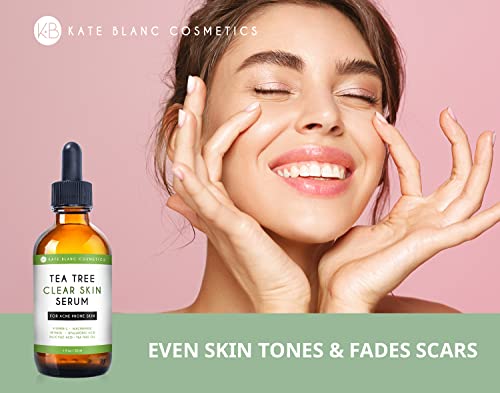 Tea Tree Serum for Face and Acne Prone Skin (1oz) by Kate Blanc Cosmetics. Tea Tree Oil Face Serum to Fight Acne Scars, Pimples, Dark Spots. Promotes Clear Skin for Teens