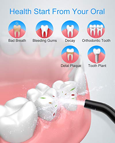 Nicefeel Cordless and Rechargeable Water Flosser - 300ML Water Tank Oral Irrigator, 4 Jet Tips, 3 Pressure Modes - IPX7 Waterproof and Travel Friendly for Dental Care