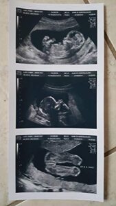 prank 2d customized fake ultrasound strip of 3 photos