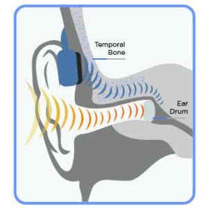 Seriously, No Bluetooth - Waterproof 8 GB Swimbuds Bone Conduction Bundle for Swimming with Music | Drag and Drop MP3, AAC, M4a, FLAC Using PC or Mac (No Spotify, or Other Streaming Services)