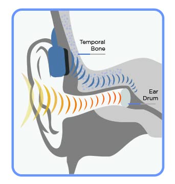 Seriously, No Bluetooth - Waterproof 8 GB Swimbuds Bone Conduction Bundle for Swimming with Music | Drag and Drop MP3, AAC, M4a, FLAC Using PC or Mac (No Spotify, or Other Streaming Services)