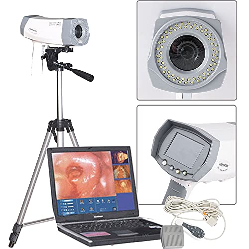 zorvo Digital Electronic Camera Gynecologist Scope Camera,800000 Pixels, Gynecologist Magnifier Camera,with Tripod【US Shipping】