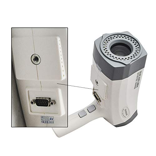 zorvo Digital Electronic Camera Gynecologist Scope Camera,800000 Pixels, Gynecologist Magnifier Camera,with Tripod【US Shipping】
