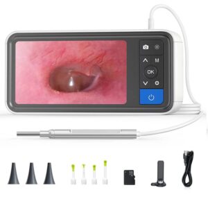 digital otoscope with 4.5″ screen & 3.9mm ear camera & 32gb card, 6 adjustable leds, 2500mah rechargeable battery, ip67 waterproof, ear wax removal tool, supports photo snap and video recording