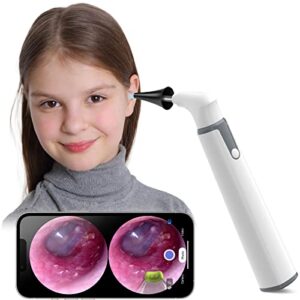 wireless otoscope ear camera with dual view, 3.9mm 720phd wifi ear scope with 6 led lights for kids and adults, compatible with android and iphone