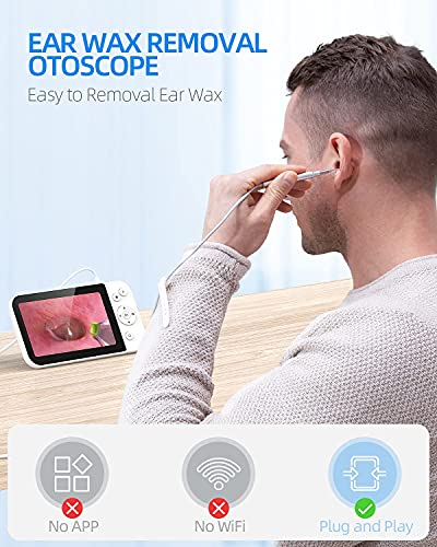 Digital Otoscope with Light, Ear Camera with Ear Wax Removal Tool, ScopeAround Ear Cleaning Camera with 5" Screen for Kids, Adults & Pets, Ear Scope, 32GB Card Supports Photo and Video Recording.