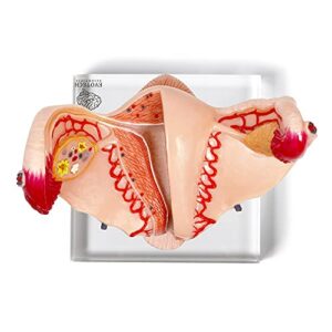 Human Uterus Ovary Urinary Bladder Model On Plexiglass Base, Female Reproductive Organ Model, Female Genital Organ, Shows Uterus, Ovary, Vagina, Uterine Medical Teaching Anatomical Gynecology