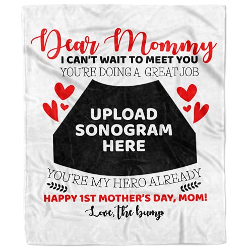 Personalized Sonogram Photo Blanket for Parents to Be Customized Ultrasound Picture Blanket for First Time Mom Dad Unique Custom Sonogram Picture Pregnancy Announcement Fleece Throw (50x60)