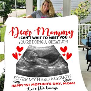Personalized Sonogram Photo Blanket for Parents to Be Customized Ultrasound Picture Blanket for First Time Mom Dad Unique Custom Sonogram Picture Pregnancy Announcement Fleece Throw (50x60)