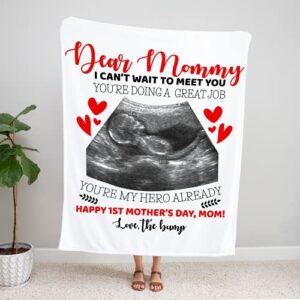 Personalized Sonogram Photo Blanket for Parents to Be Customized Ultrasound Picture Blanket for First Time Mom Dad Unique Custom Sonogram Picture Pregnancy Announcement Fleece Throw (50x60)