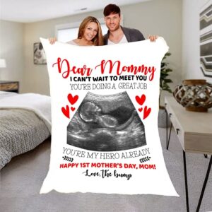 Personalized Sonogram Photo Blanket for Parents to Be Customized Ultrasound Picture Blanket for First Time Mom Dad Unique Custom Sonogram Picture Pregnancy Announcement Fleece Throw (50x60)