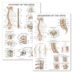 palace learning 2 pack: anatomy of the spine + disorders of the spine poster set - set of 2 anatomical charts - laminated - 18" x 24"