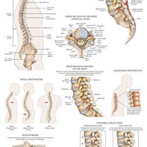 2 Pack: Spinal and Cranial Nerves + Disorders of the Spine Poster Set - Set of 2 Anatomical Charts - Laminated - 18" x 24"