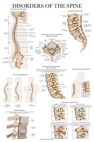 2 Pack: Spinal and Cranial Nerves + Disorders of the Spine Poster Set - Set of 2 Anatomical Charts - Laminated - 18" x 24"