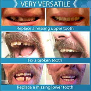 Complete Your Smile Tooth Replacement Kit DELUXE PACK - Includes Patented Complete Your Smile Tooth Replacement Kit and Jar of Instant Smile Replacement Beads