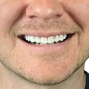 2 Pack - Instant Smile Natural Shade Comfort Fit Flex Veneers - Fix Your Smile from The Comfort of Your own Home in just Minutes! Hand Crafted