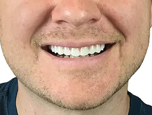 2 Pack - Instant Smile Natural Shade Comfort Fit Flex Veneers - Fix Your Smile from The Comfort of Your own Home in just Minutes! Hand Crafted
